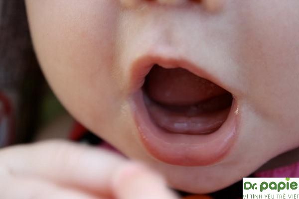 Khi răng mọc lên sẽ gây ngứa lợi, chú ý các đồ chơi của trẻ vì dễ cho vào mồm để nhai